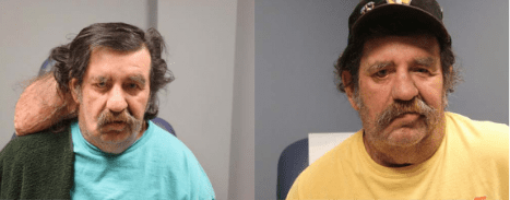 Reconstructive Surgery Before & After Gallery Section Photo