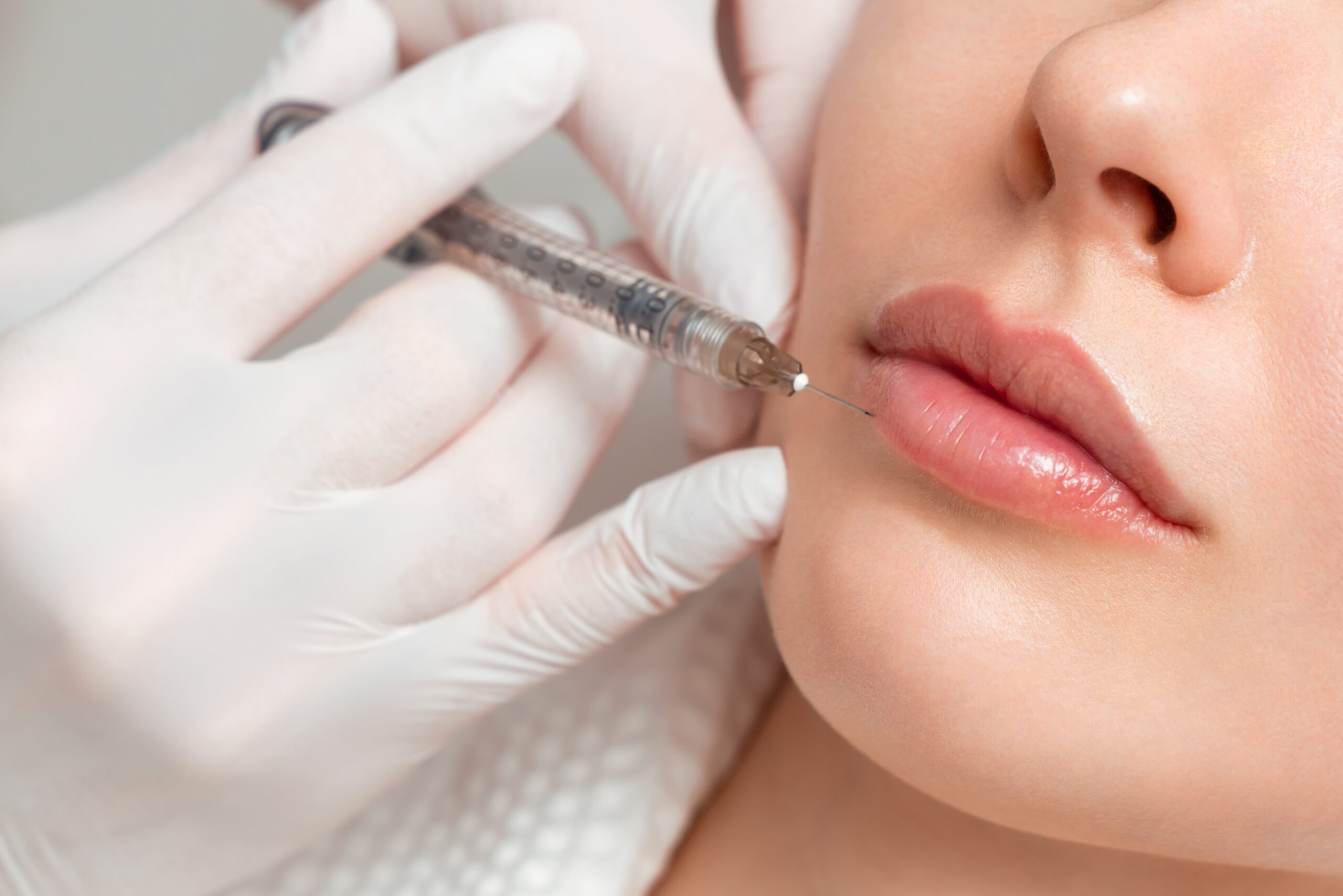 A woman makes lip shape correction in a cosmetology clinic. Lips injections, lip augmentation.