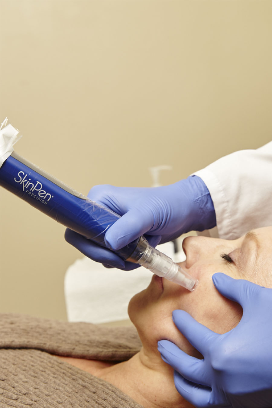 microneedling